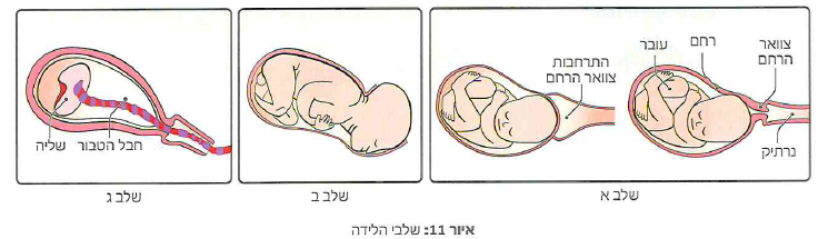 (בספר תרשים של כרזה)